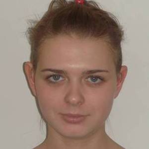 Отопластика – фотография до процедуры (пациент)